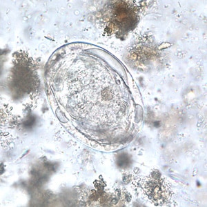 Figure E: Egg of <em>S. Japonicum</em> in an unstained wet mount of stool.