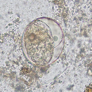 Figure C: Egg of <em>S. japonicum</em> in an unstained wet mount of stool. The spine is not visible in either of these specimens.