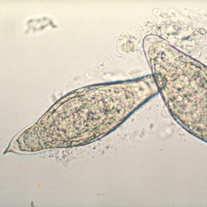 aschelminthes phylum miért kell eltávolítania a papillómákat