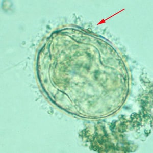 Figure A: Egg of <em>S. mekongi</em>. Note the inconspicuous spine (red arrow).
