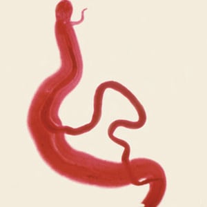 Figure A: Adults of <em>S. mansoni</em>. The thin female resides in the gynecophoral canal of the thicker male.
