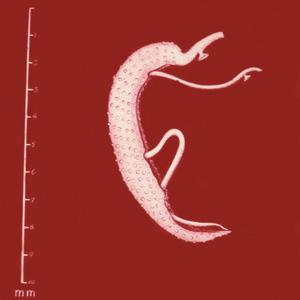 CDC - DPDx - Schistosomiasis Infection