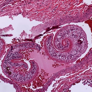 Figure A: Adults of <em>Schistosoma</em> sp. in lung tissue, stained with H&E. Image courtesy of Harvard Medical School, Cambridge, MA.