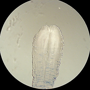 Figure C: Close-up of the anterior end of the sparganum in Figures A and B. Note the end is thickened and wrinkled, and possesses a characteristic cleft-like invagination. 