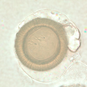 Figure E: Unstained <em>Taenia</em> sp. egg, teased from a proglottid of an adult. Four hooks can easily be seen in this image.
