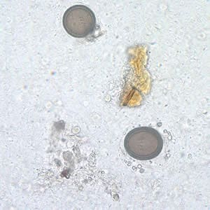Figure A: <em>Taenia</em> sp. eggs in unstained wet mounts.