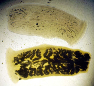 Figure D: Mature proglottid of <em>T. solium</em>, stained with India ink. Note the number of primary uterine branches (<13) in the lower specimen.