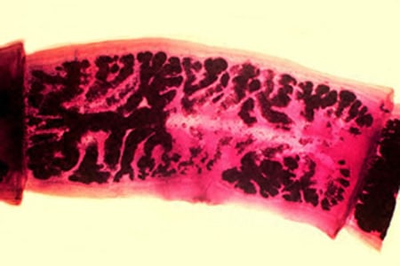 Figure C: Mature proglottid of <em>T. solium</em>, stained with carmine. Note the number of primary uterine branches (<13).