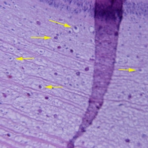 Figure E: Close-up of a cross-section of a <em>Taenia</em> sp. proglottid stained with H&E, showing numerous calcareous corpuscles (yellow arrows). Image courtesy of the Michael E. DeBakey V. A. Medical Center in Houston, TX.