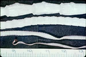 Figure B: <em>Taenia</em> saginata adult worm.