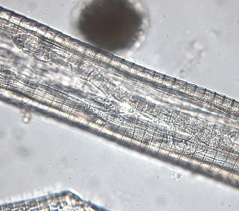 Figure B: Mid-section of a female <em>Thelazia californiensis</em>. Note the prominent, widely spaced, and serrate cuticular striations.