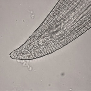 Figure C: Posterior end of a female <em>Thelazia californiensis</em> with protruding anal opening and phasmids.