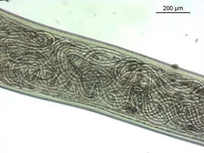 Figure D: Mid-section of adult female Thelazia callipaeda showing live larvae in utero