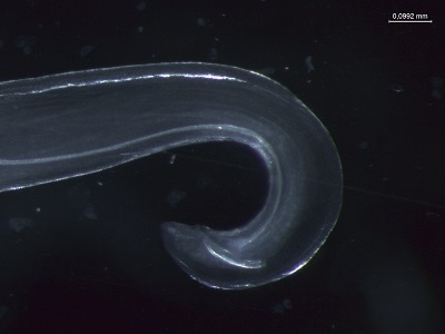 Figure E: Posterior of adult male Thelazia callipaeda showing spicules (Nomarsky phase contrast).