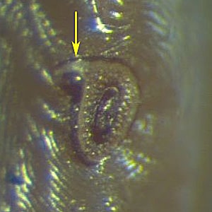Figure F: Spiracular plate of <em>D. andersoni</em>. Notice the more pronounced dorsal prolongation (arrow) of the plate and the larger, yet fewer in number, goblet cells on the plate. Image courtesy of the Washington State Public Health Laboratories.