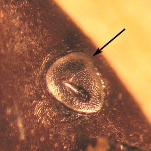 Figure E: Spiracular plate of <em>D. variabilis</em>. Notice the slight dorsal prolongation (arrow) of the plate and large number of smaller goblet cells on the plate.