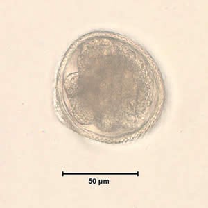 Figure B: <em>Toxocara</em> sp. egg teased from an adult worm. The worm was never identified, but the egg size is most consistent with T. cati. Image courtesy of the New Jersey State Public Health Laboratory.