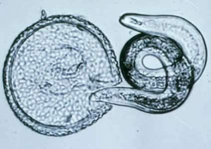 Figure B: <em>T. canis</em> larva hatching.
