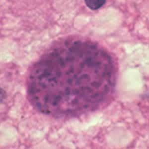 Figure B: <em>Toxoplasma gondii</em> cyst stained with hematoxylin and eosin.