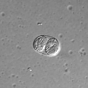 Figure B: <em>Toxoplasma gondii</em> sporulated oocyst in an unstained wet mount, viewed under differential interference contrast (DIC) microscopy.