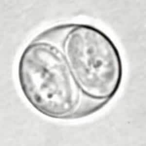 Figure A: <em>Toxoplasma gondii</em> sporulated oocyst in an unstained wet mount.