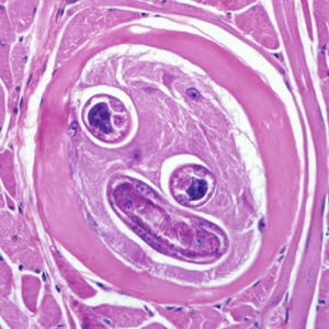 Figure B: Encysted larvae of <em>Trichinella</em> sp. in muscle tissue, stained with hematoxylin and eosin (H&E). The image magnification is 400x. 