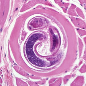 Figure D: Encysted larvae of <em>Trichinella</em> sp. in muscle tissue, stained with hematoxylin and eosin (H&E). Image was were captured at 400x magnification.