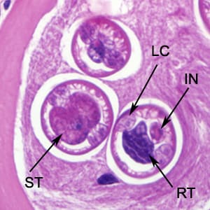 Figure E: Higher-magnification of the larvae in Figure C. Shown in these cuts are a nucleated stichocyte (ST), prominent lateral chords, or bacillary bands, (LC), immature reproductive tubes (RT), and the intestine (IN). Image captured at 1000x magnification.