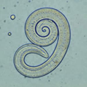 Figure E: Larva of <em>Trichinella</em> liberated from bear meat. This larva is from a different case than those shown in Figures A-D.