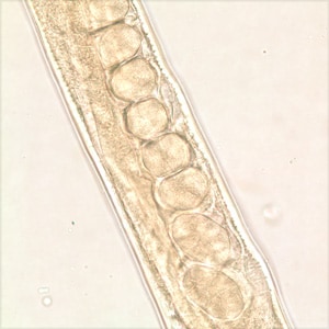 Figure C: Midsection of the same specimen from Figures A and B.  Note a row of eggs in the uterus.
