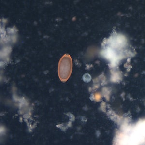 Figure E: Egg of <em>T. trichiura</em> viewed with UV microscopy.