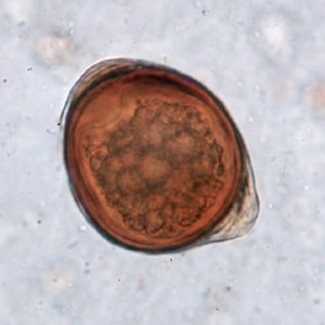 Figure B: Atypical egg of <em>T. trichiura</em>.