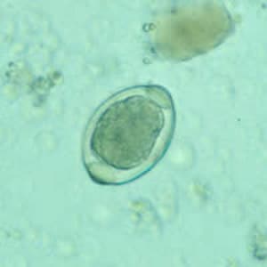 Figure C: Atypical egg of <em>T. trichiura</em>.