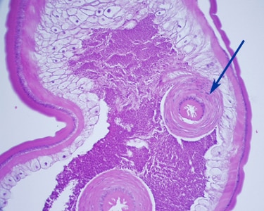 Figure D: Section of an adult <em>T. trichiura</em>, stained with H&E. Notice the thick-muscled cloaca (arrow). Image courtesy of Cambridge Health Alliance, Cambridge, MA.