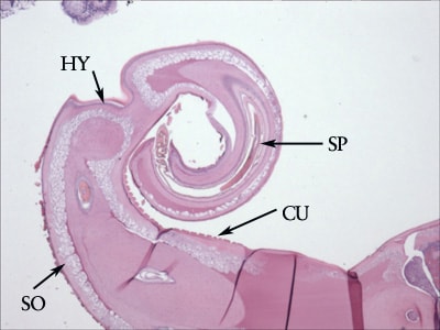 Figure C: Cross-section of the posterior end of an adult <em>T. trichiura</em>, from a colonoscopy specimen stained with Hamp;E. Note the presence of the thick cuticle with annulations (CU). Below the cuticle is the thin hypodermis (HY), and below the hypodermis is a layer of somatic muscle cells (SO). The presence of a spicule (SP) indicates the specimen is a male. Image courtesy of the Michael E. DeBakey V. A. Medical Center, Houston, TX.