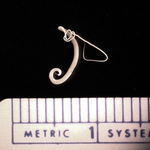 Figure B: Adult if <em>T. trichiura</em> removed during a colonoscopy.