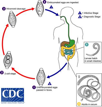 pinworm tünetek kezelése és megelőzése