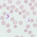 Figure C: Trypomastigotes of <em>T. brucei</em> ssp. in a blood smear stained with Giemsa.