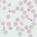Figure D: Trypomastigotes of <em>T. brucei</em> ssp. in a blood smear stained with Giemsa.