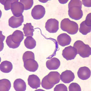 Figure D: <em>Trypanosoma brucei</em> ssp. in a thin blood smear stained with Wright-Giemsa.