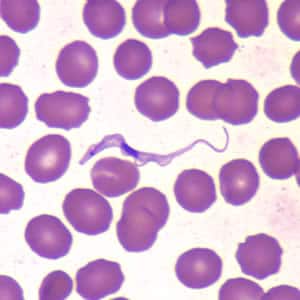 Figure E: <em>Trypanosoma brucei</em> in a thin blood smear stained with Wright-Giemsa.