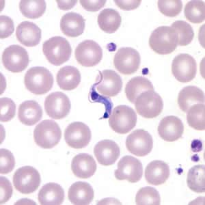 Figure C: <em>T. cruzi</em> trypomastigote in a thin blood smear stained with Giemsa. Note the more anterior location of the nucleus.