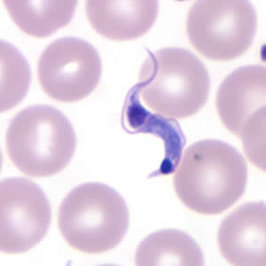 https://www.cdc.gov/dpdx/trypanosomiasisamerican/images/3/Tcruzi_thin_giemsa5_zoom.jpg?_=04509