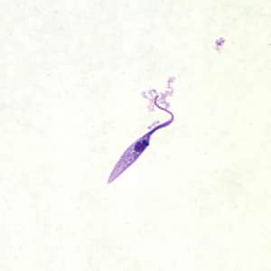 Figure A: <em>Trypanosoma cruzi</em> epimastigote from culture. Note the location of the kinetoplast anterior to the nucleus.