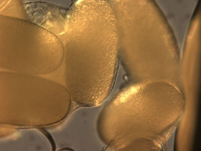 Figure C: Close-up of the eggs from the specimen in Figure B.