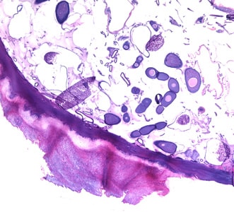 Figure C: Cross-sections of <em>T. penetrans</em> in tissue, stained with hematoxylin and eosin (H&E).