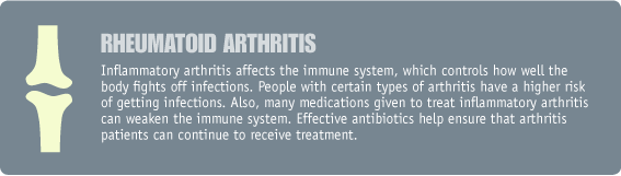  rheumatoid arthritis image