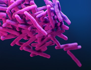 Medical illustration of Drug-resistant Tuberculosis