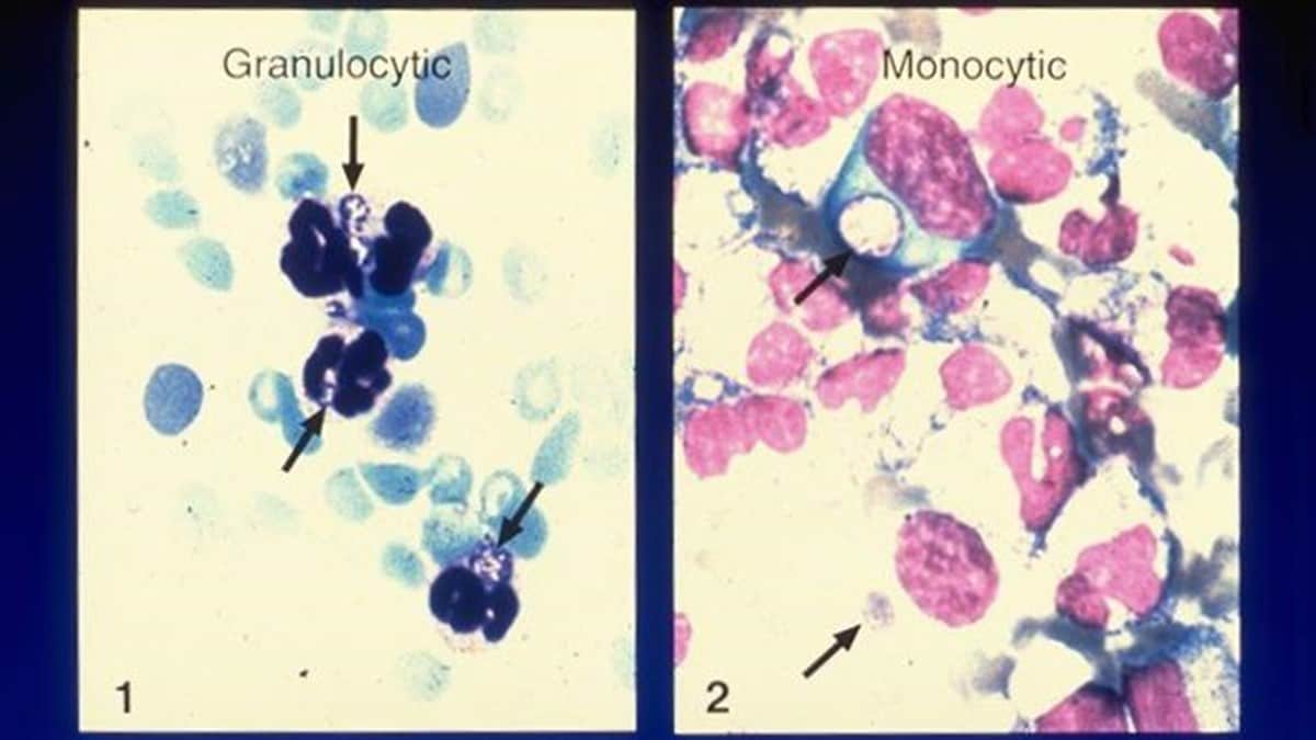 Two photomicrographs showing types of ehrlichiosis.