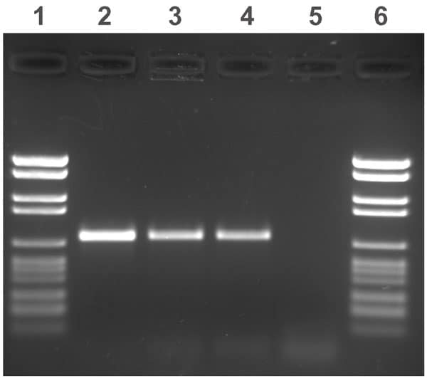Agarose gel electrophoresis of amplified IS900 fragments. Lanes 1 and 6: molecular weight marker (2176, 1766, 1230, 1033, 653, 517, 453, 394, 298, 234–220, 154 bp); lanes 2 and 3: two patient samples; lane 4: positive control (Mycobacterium avium subsp. paratuberculosis type strain); and lane 5: negative control (Mycobacterium avium strain).